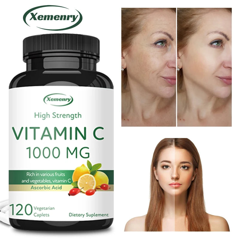 Vitamina C 1000 mg Xemenry | Refuerzo Inmunológico, Antioxidante y Apoyo para Piel, Corazón y Dientes